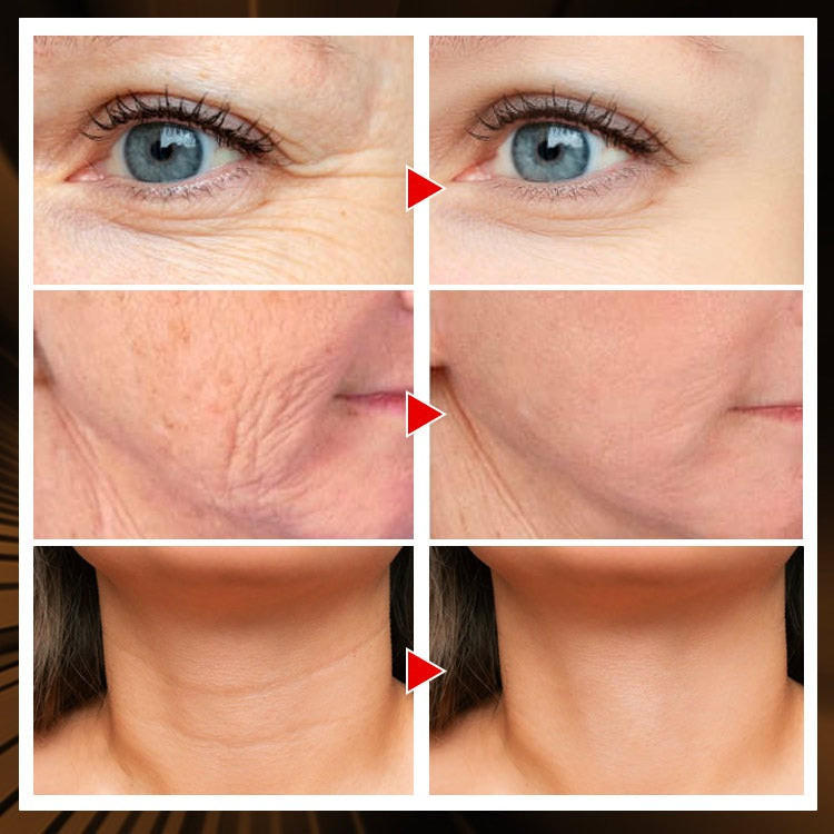 1 masseur facial Shinehouse™acheté un sérum pour le visage offert !